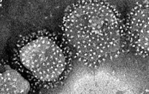 Vaccine candidate protects from SARS-CoV-2 infection